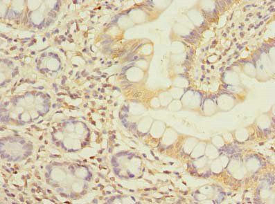 FCHSD2 Antibody
