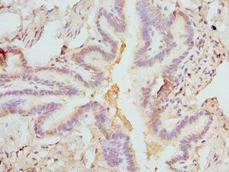 FCN1 Antibody