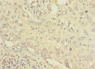 FCRL2 Antibody