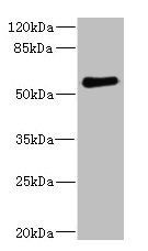 FCRL2 antibody