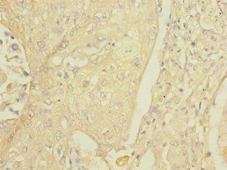 FCRL2 Antibody