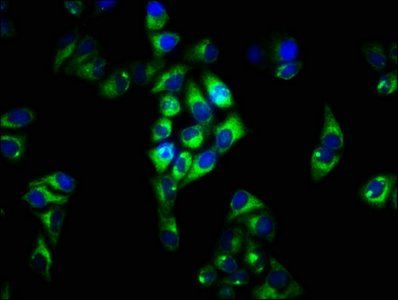 FCRL3 Antibody