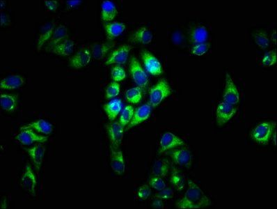 FCRL3 antibody