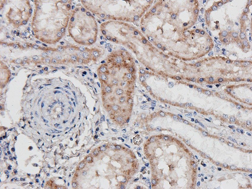 FCRL4 antibody