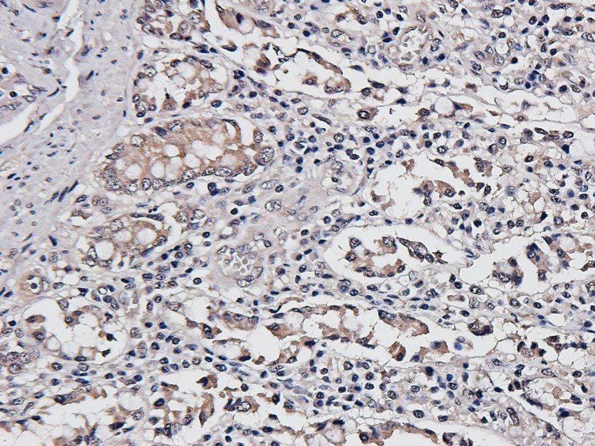 FCRL4 antibody