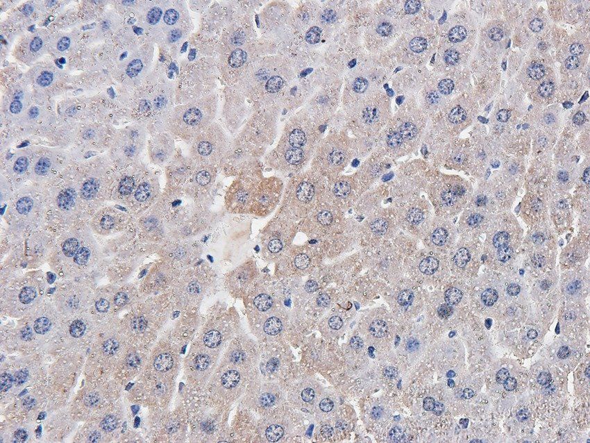 FCRL4 antibody