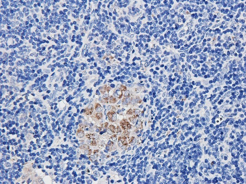 FCRL4 antibody