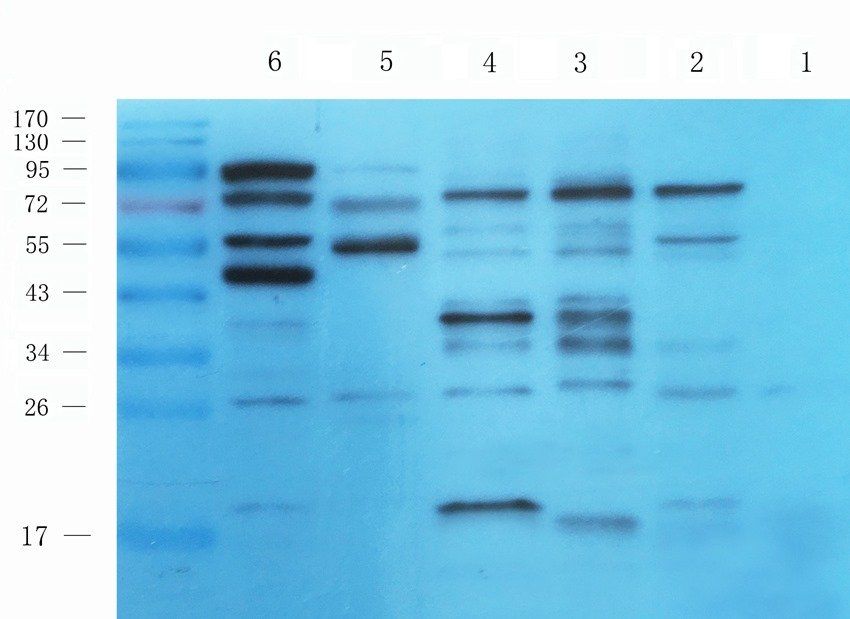 FCRL4 antibody