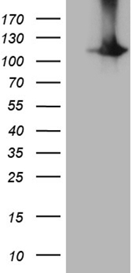 FCRLB Antibody