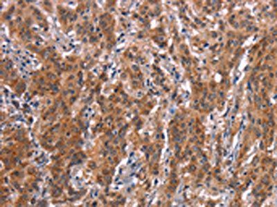 FDCSP Antibody
