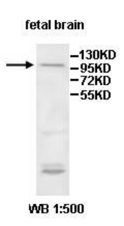 Anti-ITIH2 Antibody