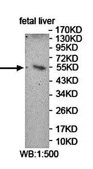 FDXR antibody