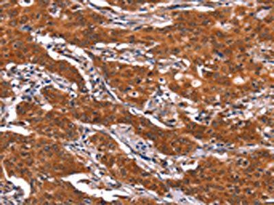 FEM1B Antibody