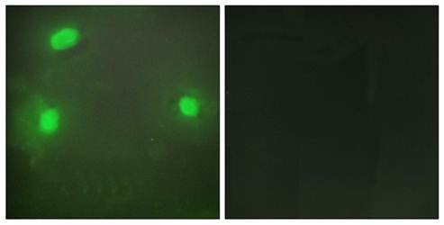 FEN1 Antibody