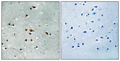 FER (Phospho-Tyr402) Antibody