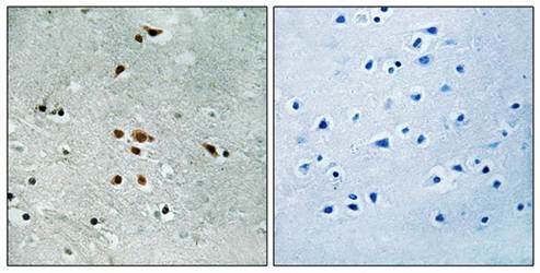 FER (phospho-Tyr402) antibody