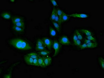 FERMT3 Antibody