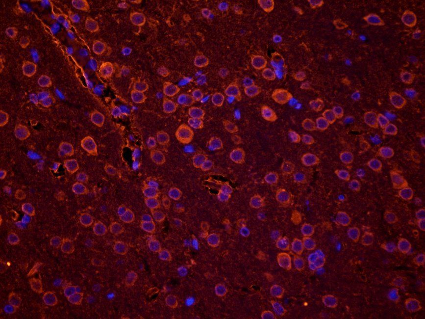 Ferritin antibody