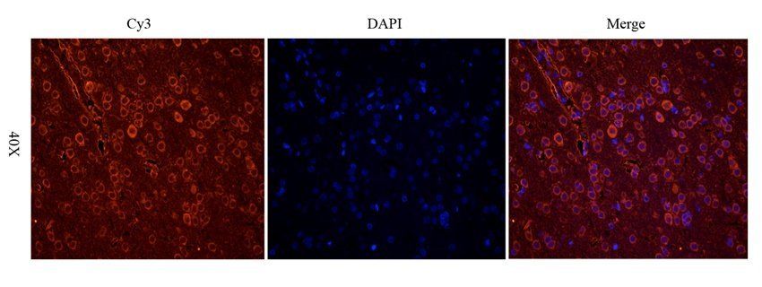 Ferritin antibody