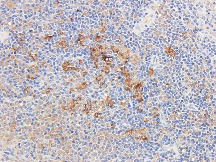 Ferritin antibody