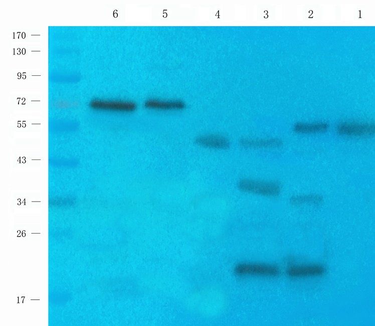 Ferritin antibody