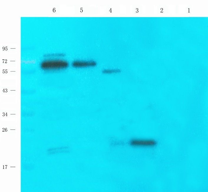 Ferritin antibody