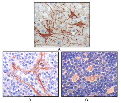 FES Antibody