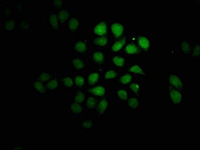 FEV Antibody
