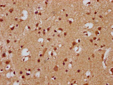 FEV Antibody