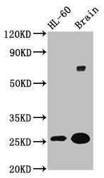 FEV antibody