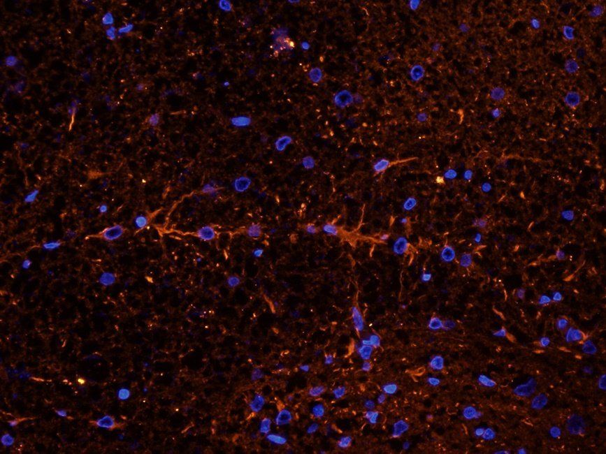 FFAR1 antibody