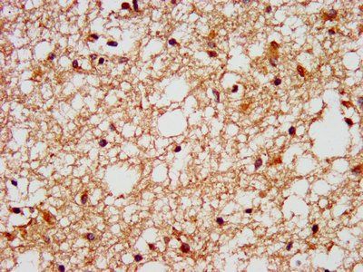 FFAR1 Antibody