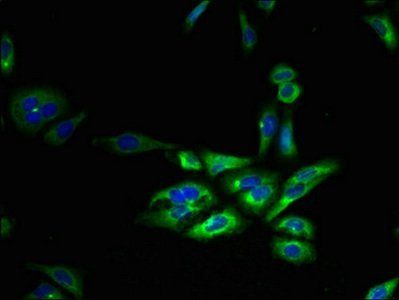 FFAR3 antibody