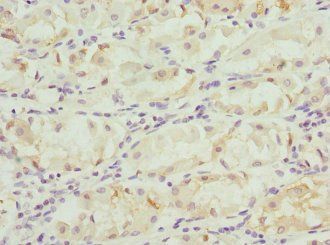 FGD5 Antibody
