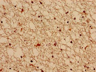 FGD6 Antibody