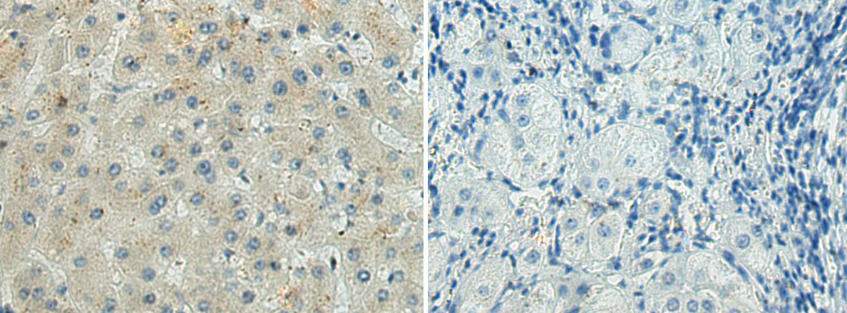 ADAMTS5 Antibody