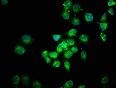 FGF1 antibody