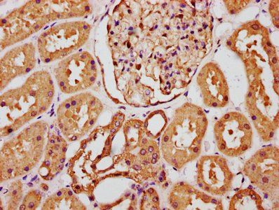 FGF1 Antibody