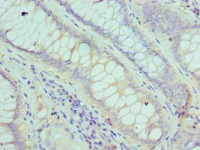 FGF1 Antibody