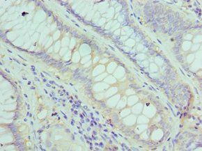 FGF1 antibody