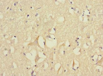 FGF12 Antibody