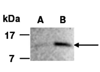 FGF1 (C1) Antibody, Rabbit Polyclonal