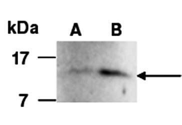 FGF1 (C3) Antibody, Rabbit Polyclonal