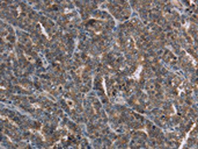 FGF20 Antibody
