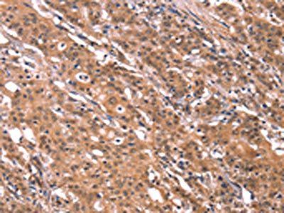 FGF22 Antibody