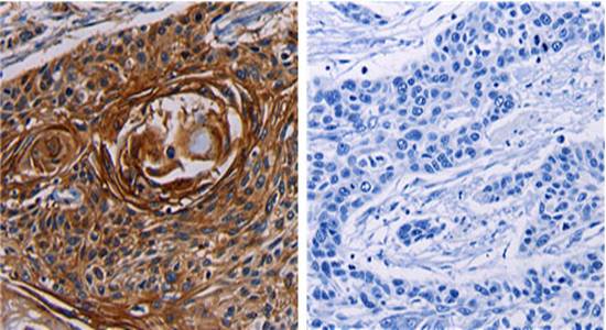 FGF7 Antibody