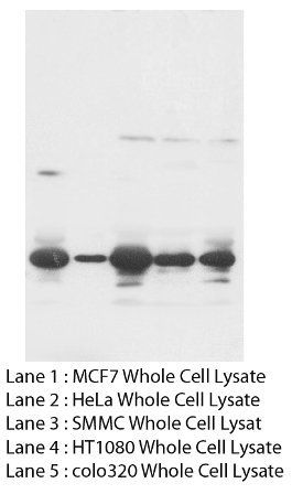 Fibroblast growth factor 8 FGF8 Antibody