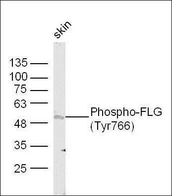 FGF Receptor 1 (phospho-Tyr766) antibody