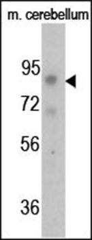 FGFR (phospho-Tyr766) antibody