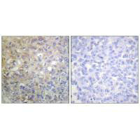FGFR1 Antibody